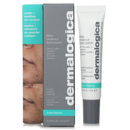 Dermalogica Deep Breakout Liquid Patch 15ml